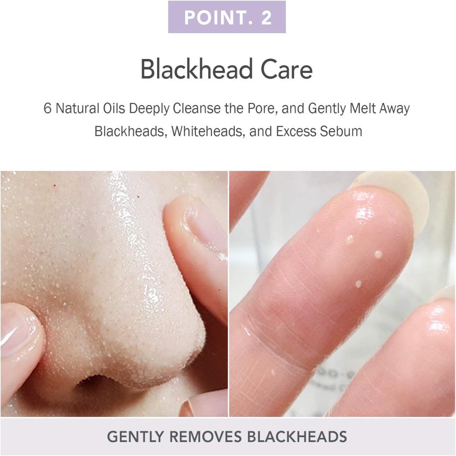 gallery-thumb-3